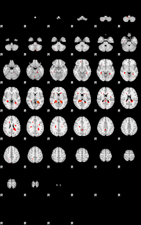 Patients 29213 98