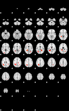 Patients 29217 10