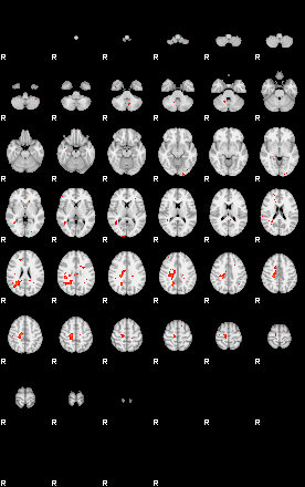 Patients 29220 153