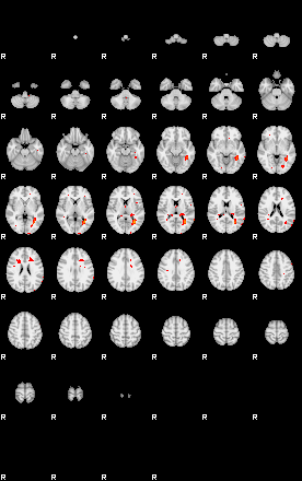 Patients 29280 48