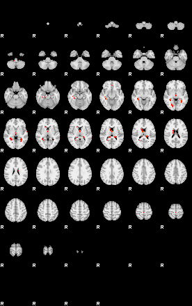 Patients 29280 51