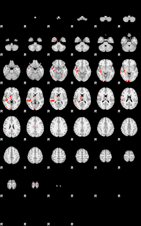 Patients 29291 196