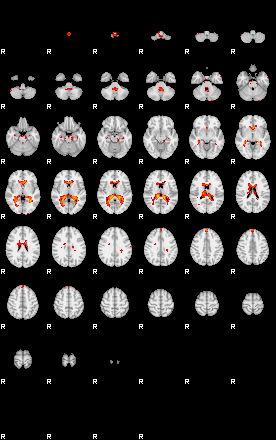 Patients 29392 50