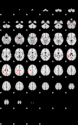 Patients 29495 12