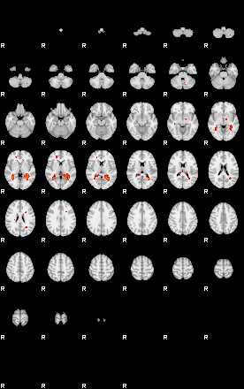 Patients 29676 192