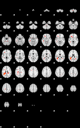 Patients 30018 182