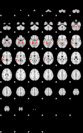 Patients 28815 130