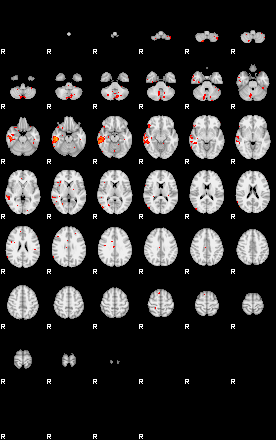 Patients 28908 4