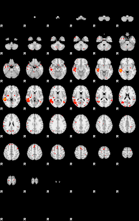 Patients 29043 45