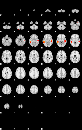 Patients 29060 82