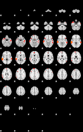 Patients 29172 99