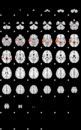 Patients 29180 83