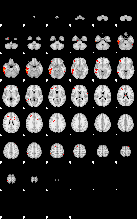 Patients 29189 198