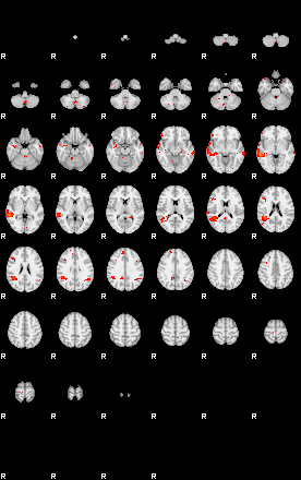 Patients 29191 99