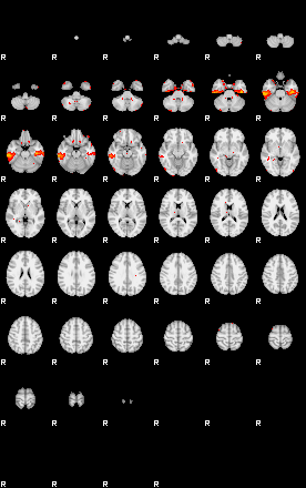 Patients 29290 78