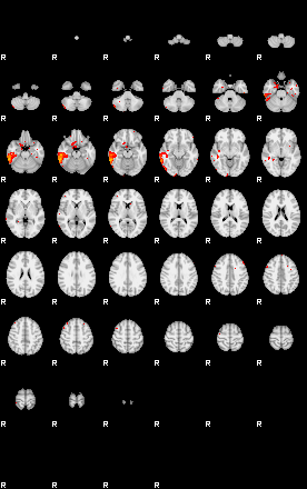 Patients 29415 169