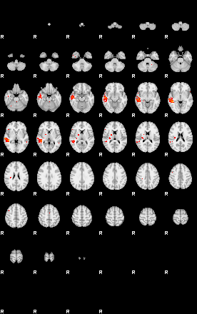 Patients 29510 70