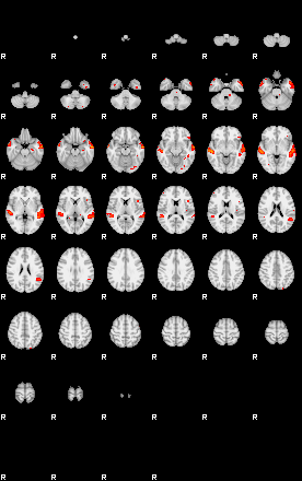 Patients 29671 169