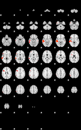 Patients 30027 85