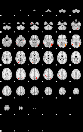 Patients 29101 64