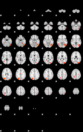 Patients 29155 2