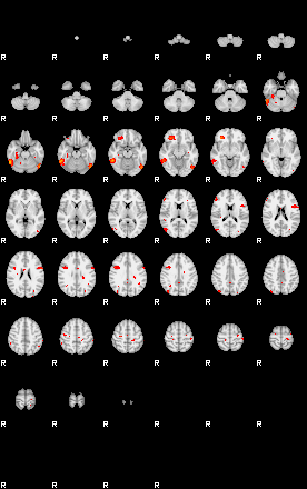 Patients 29168 200