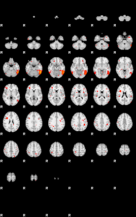 Patients 29177 152