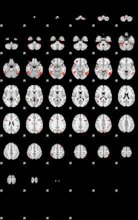 Patients 29200 142