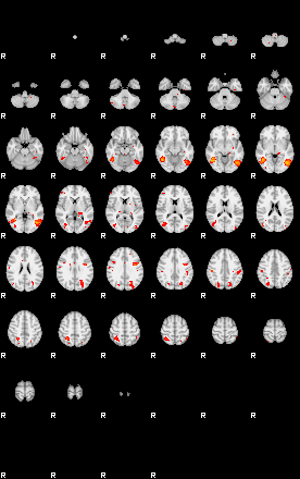 Patients 29200 151