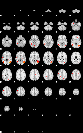 Patients 29281 143