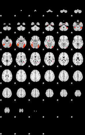 Patients 29434 158