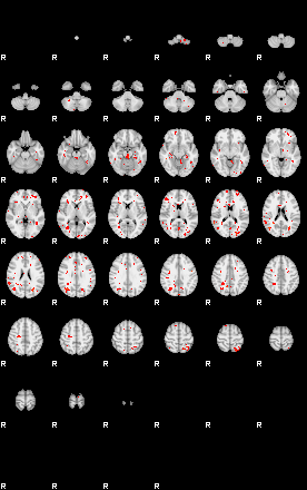 Patients 29615 185