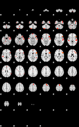 Patients 28930 169