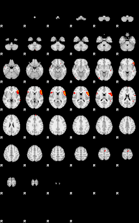 Patients 29101 100