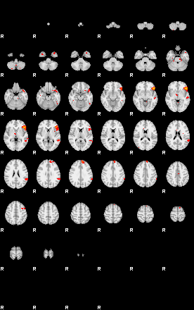 Patients 29113 34