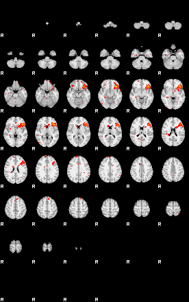 Patients 29151 200