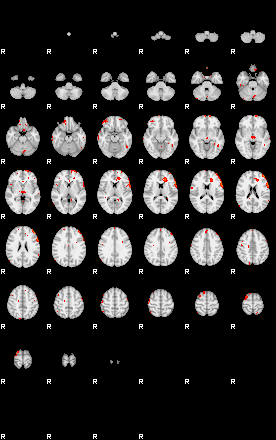 Patients 29163 161