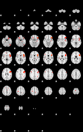 Patients 29168 189