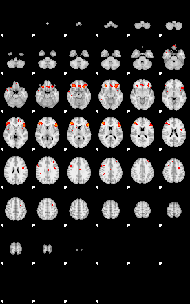 Patients 29171 106