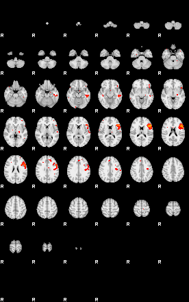 Patients 29173 51