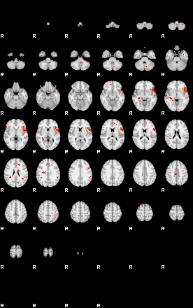 Patients 29191 184