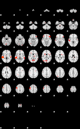 Patients 29052 136