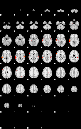 Patients 29153 154