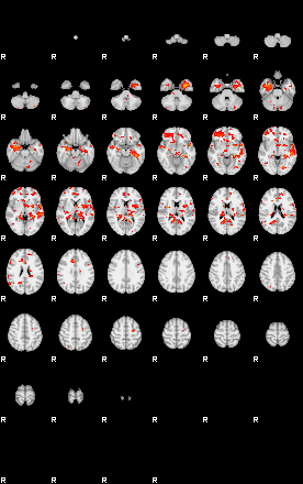 Patients 28799 21