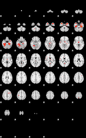 Patients 29111 80