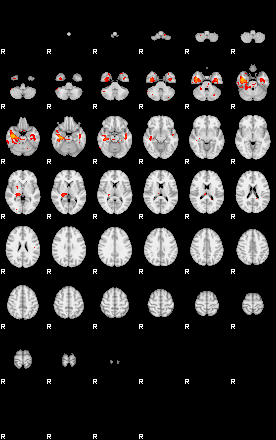 Patients 29116 4