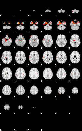 Patients 29185 109