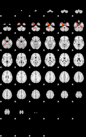 Patients 29280 105