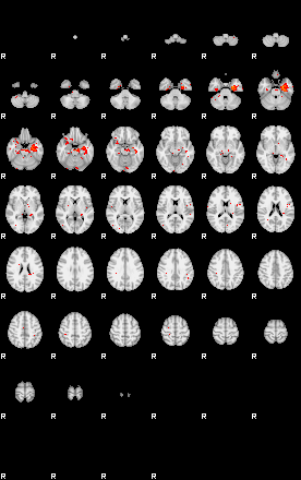 Patients 29502 150