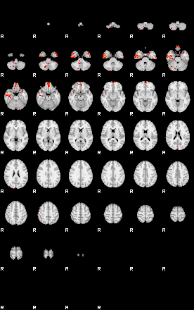 Patients 30174 3